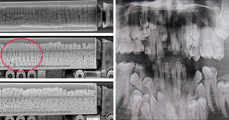 Рентгеновские снимки, которые открывают мир с неожиданной стороны (36 фото)