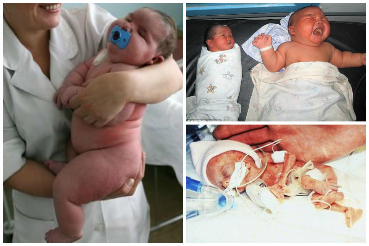 Невероятные младенцы - самые большие и самые маленькие (12 фото)